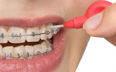 How to Handle a Dental Emergency in Wall NJ