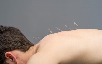 Why Acupuncture Classes Cover So Much More Than a Medical Technique